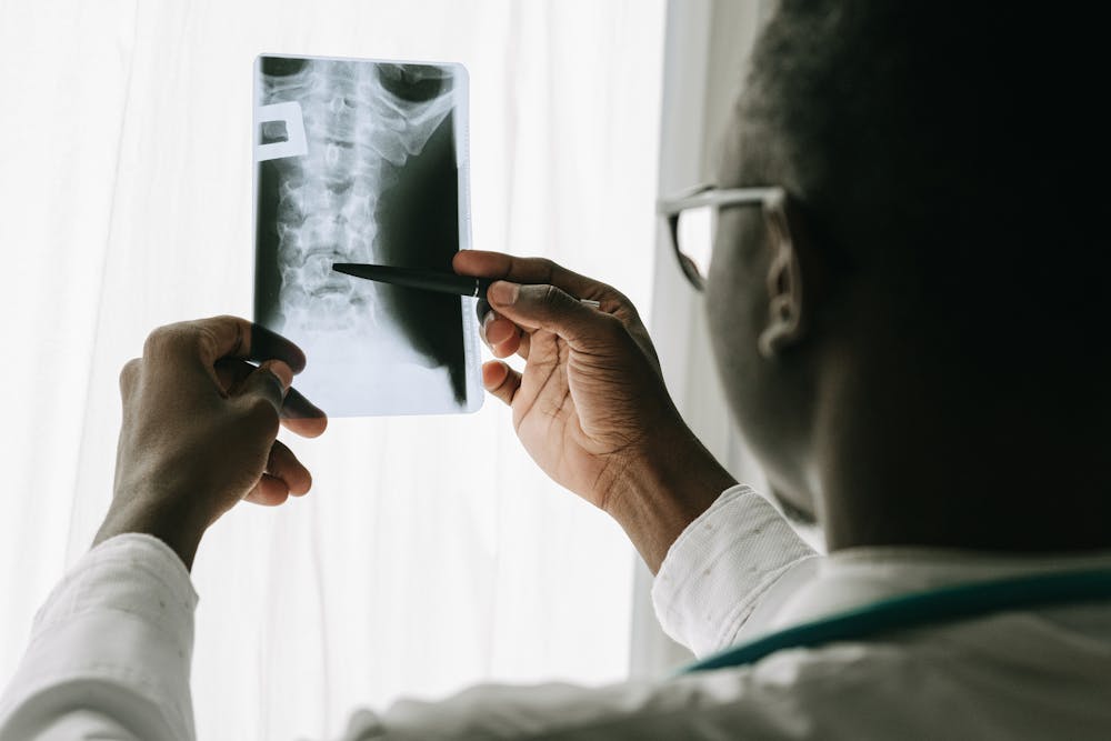cervical spine injury settlement amounts