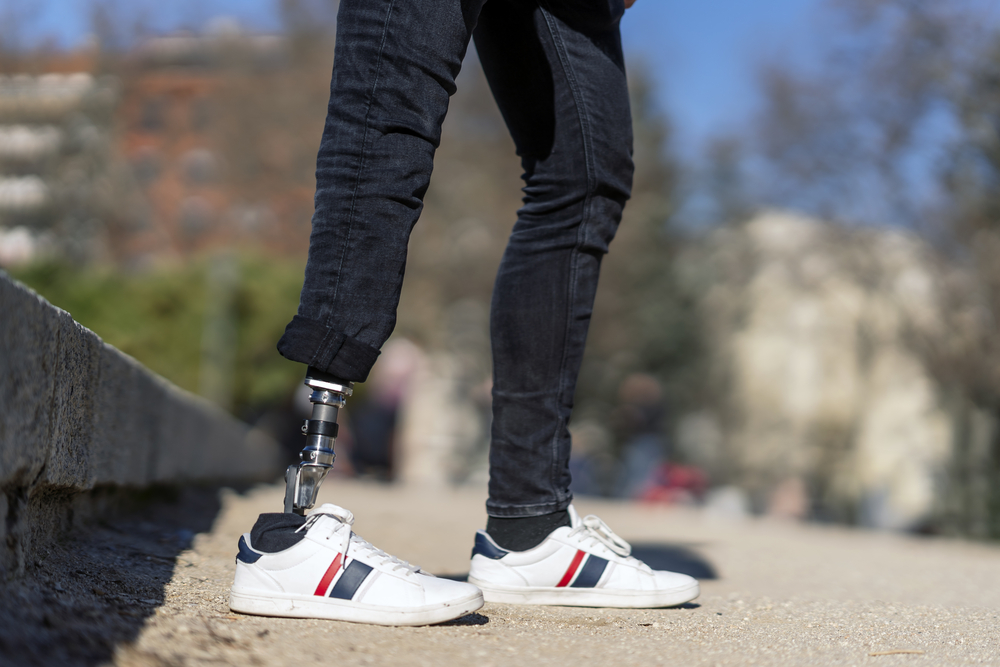 amputation from construction accident